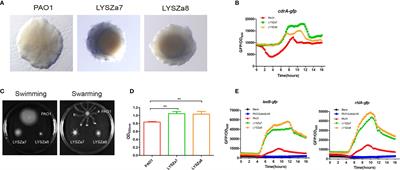 Persistent Bacterial Coinfection of a COVID-19 Patient Caused by a Genetically Adapted Pseudomonas aeruginosa Chronic Colonizer